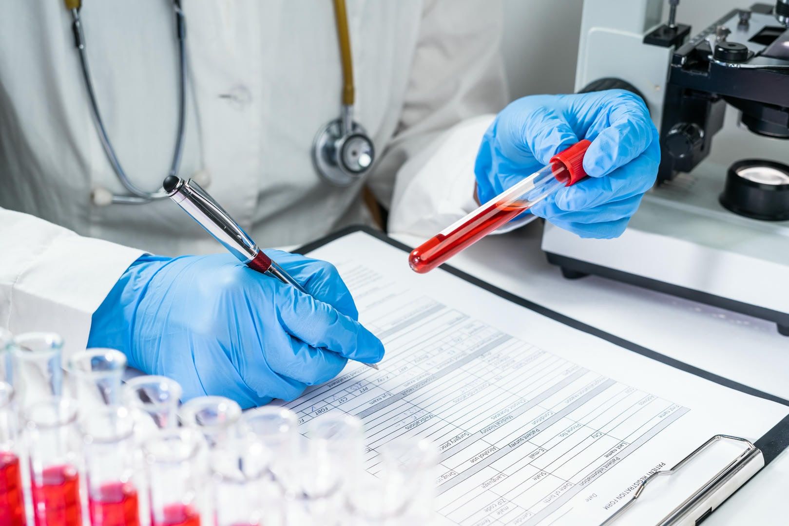 Lab technician in blue gloves, holding a blood sample and writing on a medical form near a microscope.
