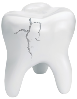cracked tooth