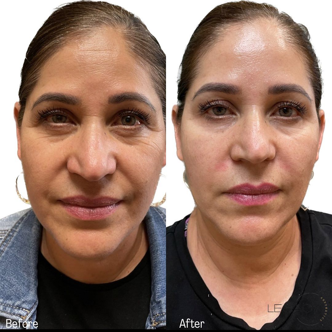 Side-by-side portrait of a woman before and after, showing smoother skin and lighter makeup on the right