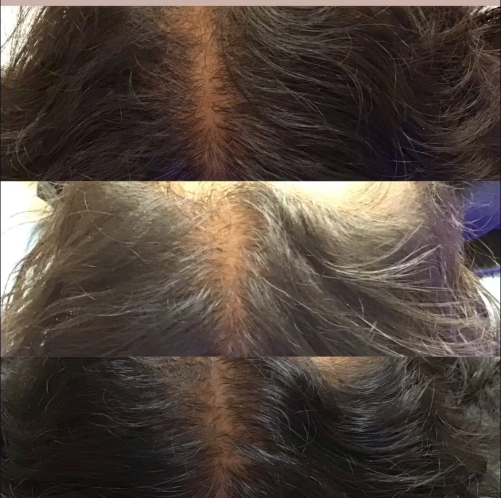Three close-up photos showing thinning hair and a visible scalp part on the top of the head