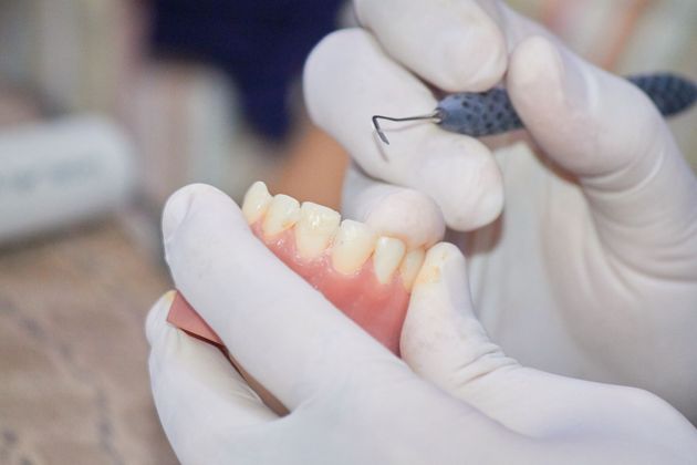Gloved hands fitting a dental implant model with pink gums and white teeth