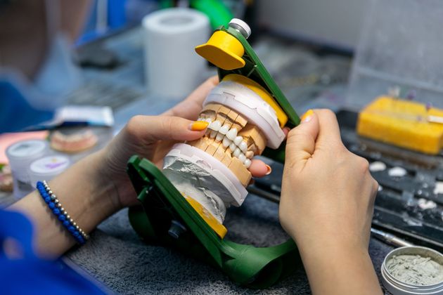 Hands holding a dental mold with green frame and yellow tool on a workbench.