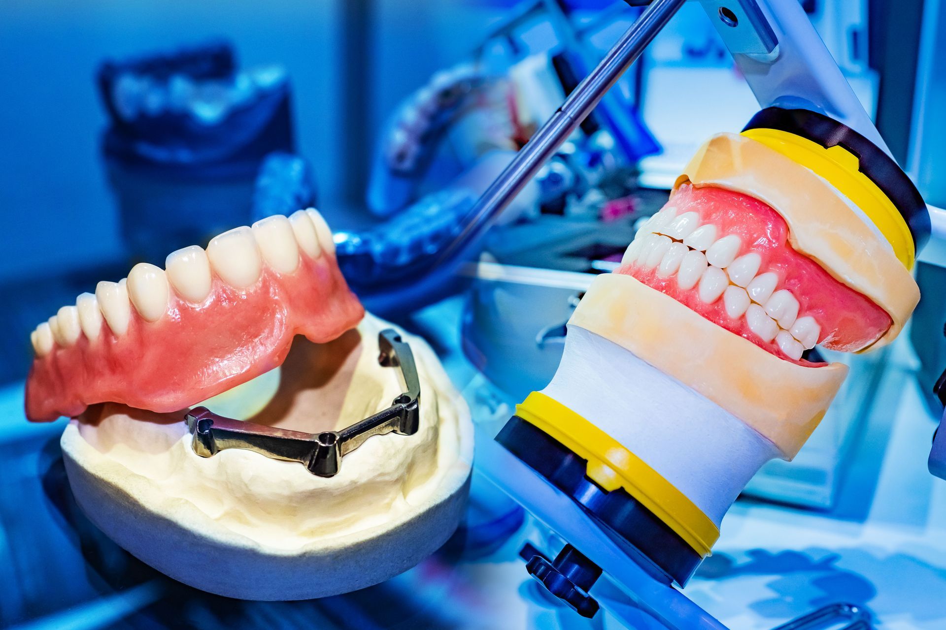 Dental dentures on display in a blue clinical setting with dental tools and model teeth Dental dentures on display in a blue clinical setting with dental tools and model teeth