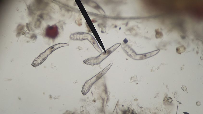 Microscopic view of several pale, worm-like larvae on a light background with a dark hair-like strand
