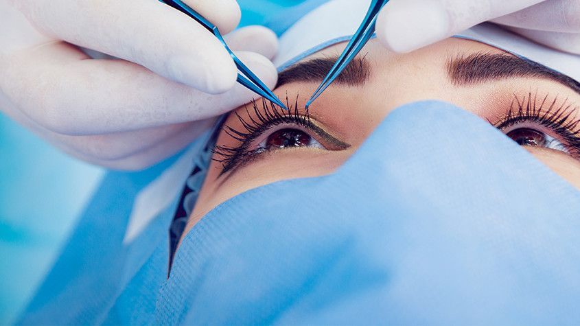 Medical professional examining a patient’s eye with blue surgical tools and gloved hands