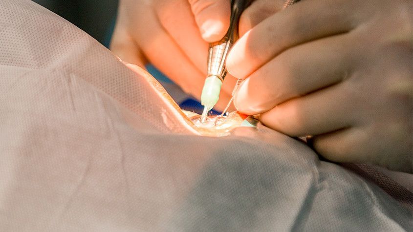 Hands use a sewing machine to stitch white fabric close-up