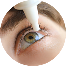 Eye being treated with eye drops from a dropper close-up