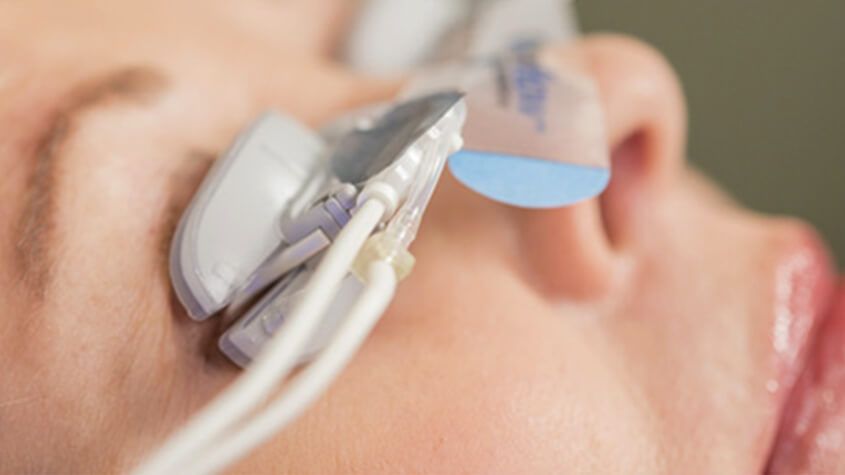 lipiflow eye treatment