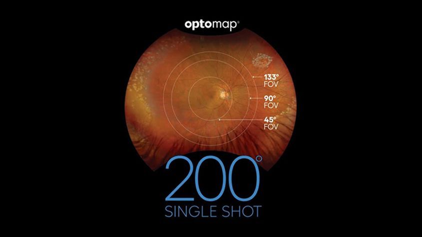 Optomap retinal scan graphic with “200 single shot” text on a dark background