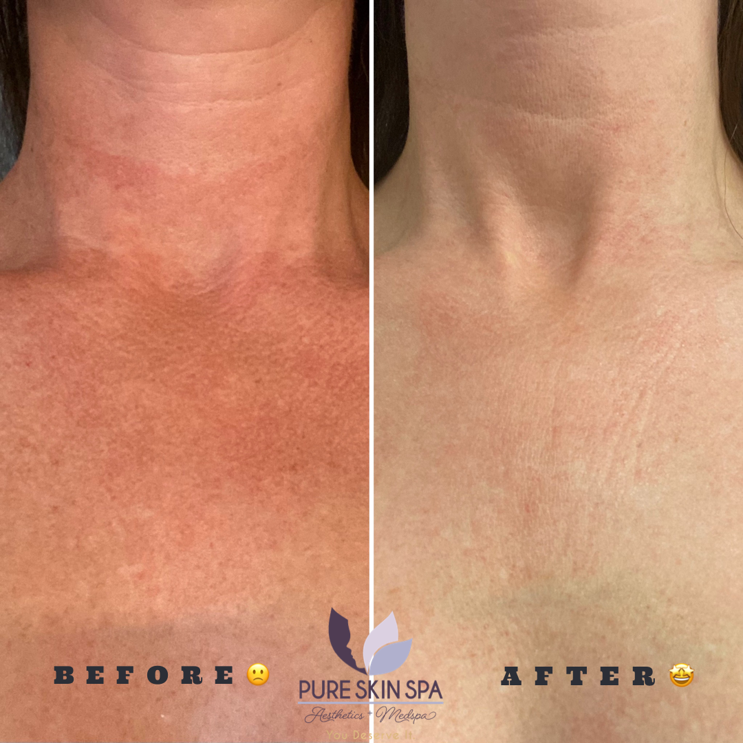 Pure Skin MedSpa Gallery