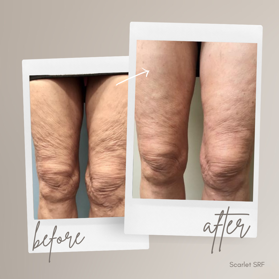 Pure Skin MedSpa Gallery