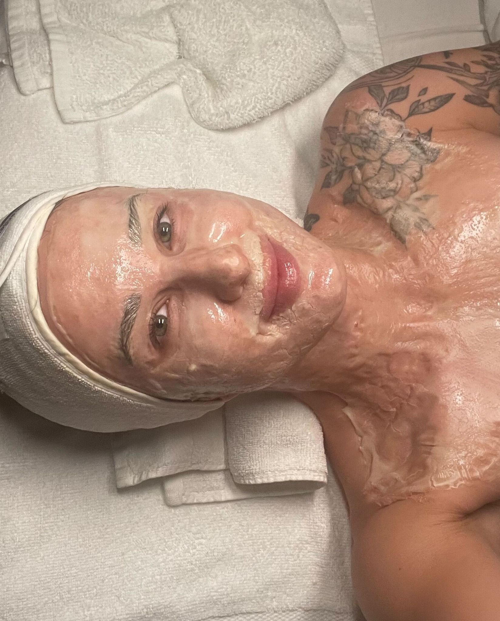 Pure Skin MedSpa Gallery