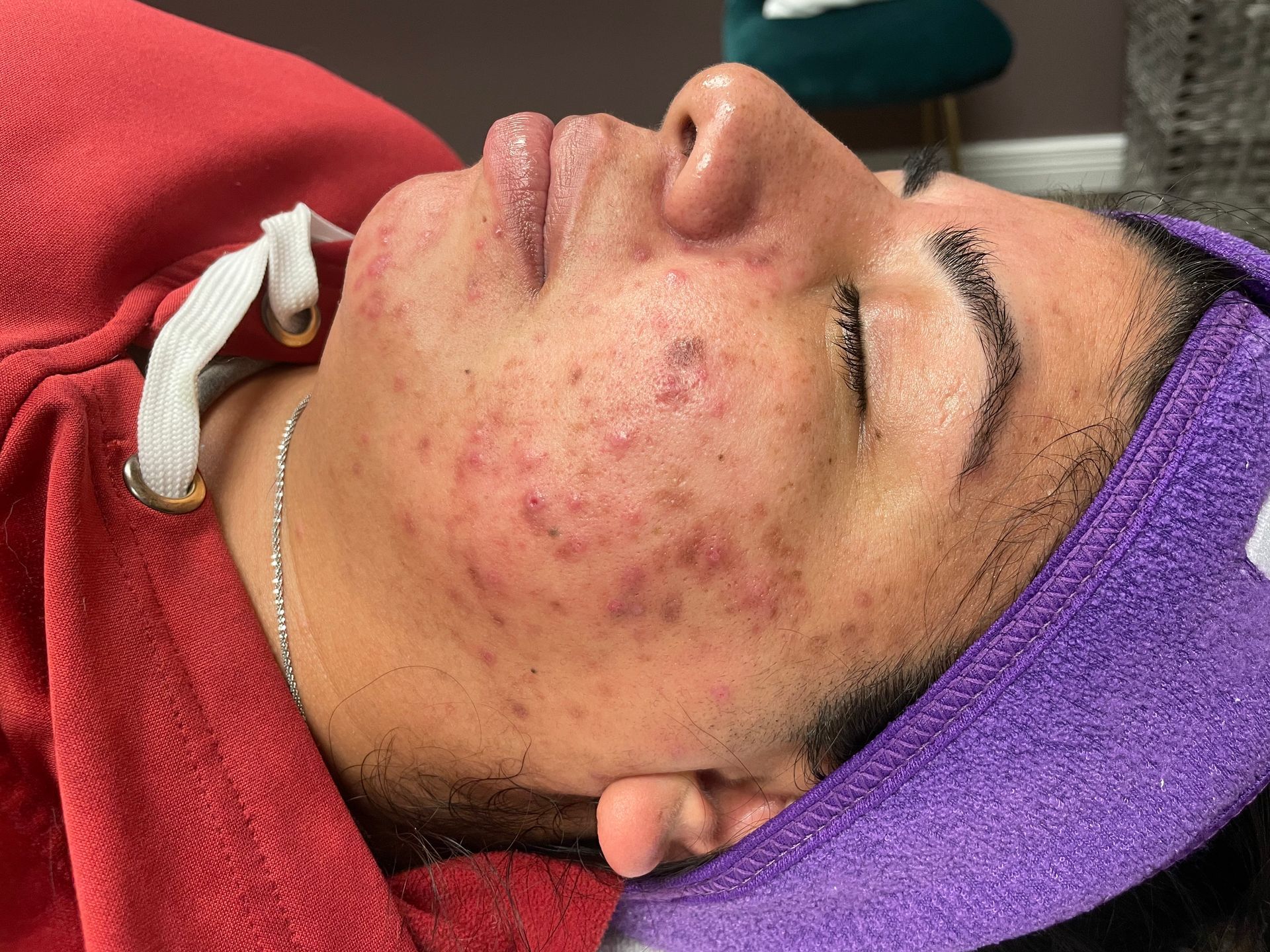 Pure Skin MedSpa Gallery