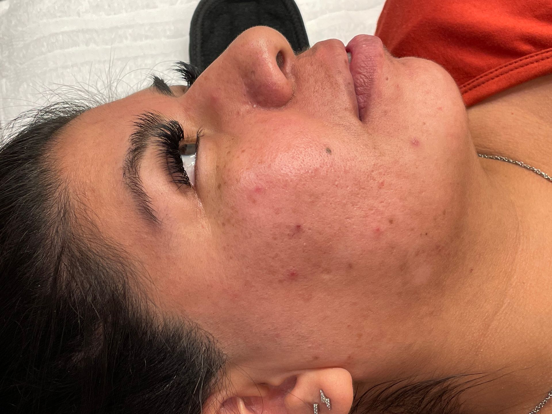 Pure Skin MedSpa Gallery