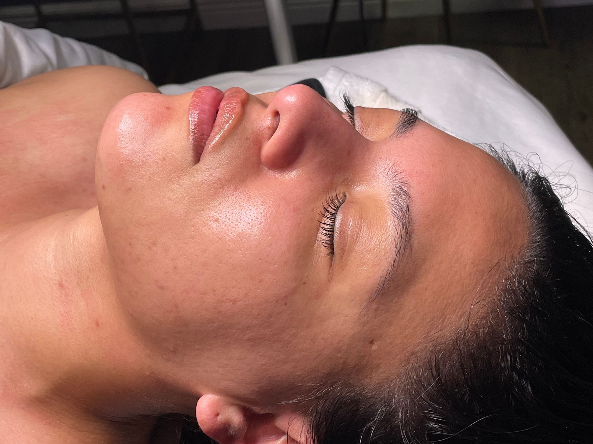 Pure Skin MedSpa Gallery