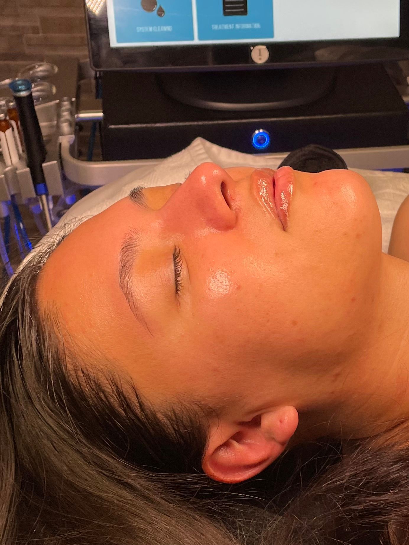 Pure Skin MedSpa Gallery
