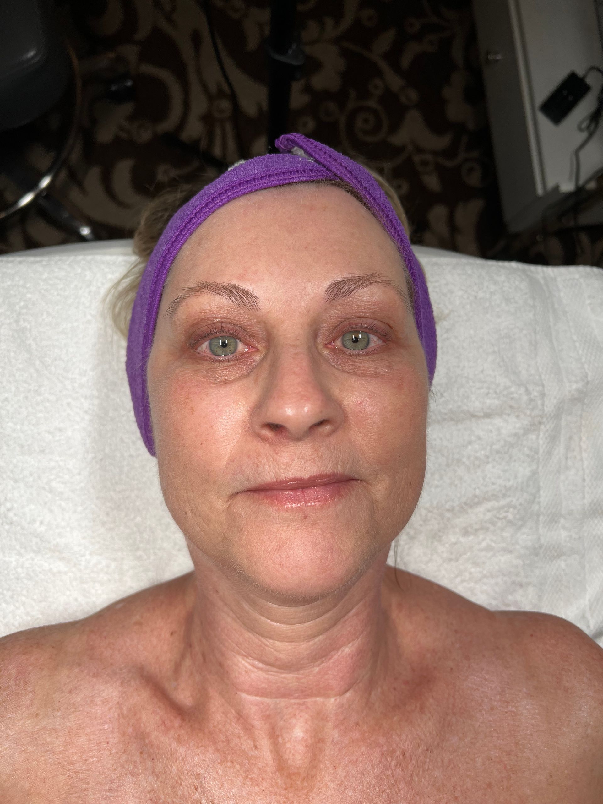 Pure Skin MedSpa Gallery