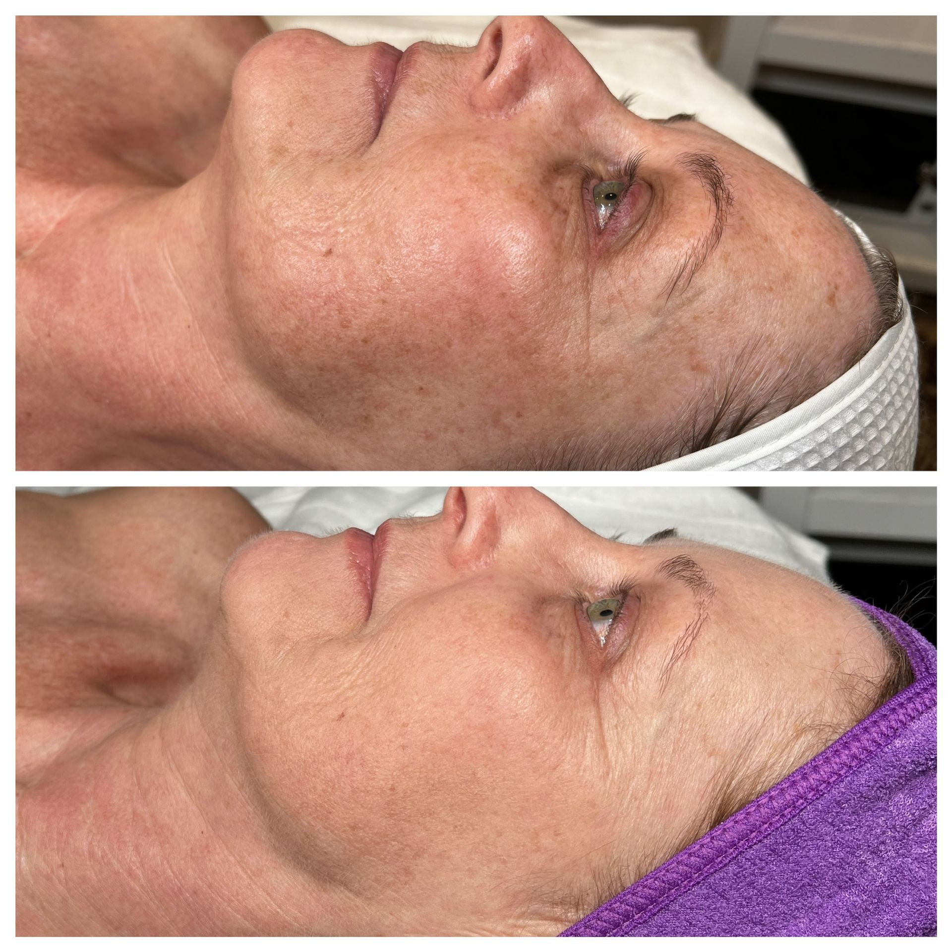 Pure Skin MedSpa Gallery