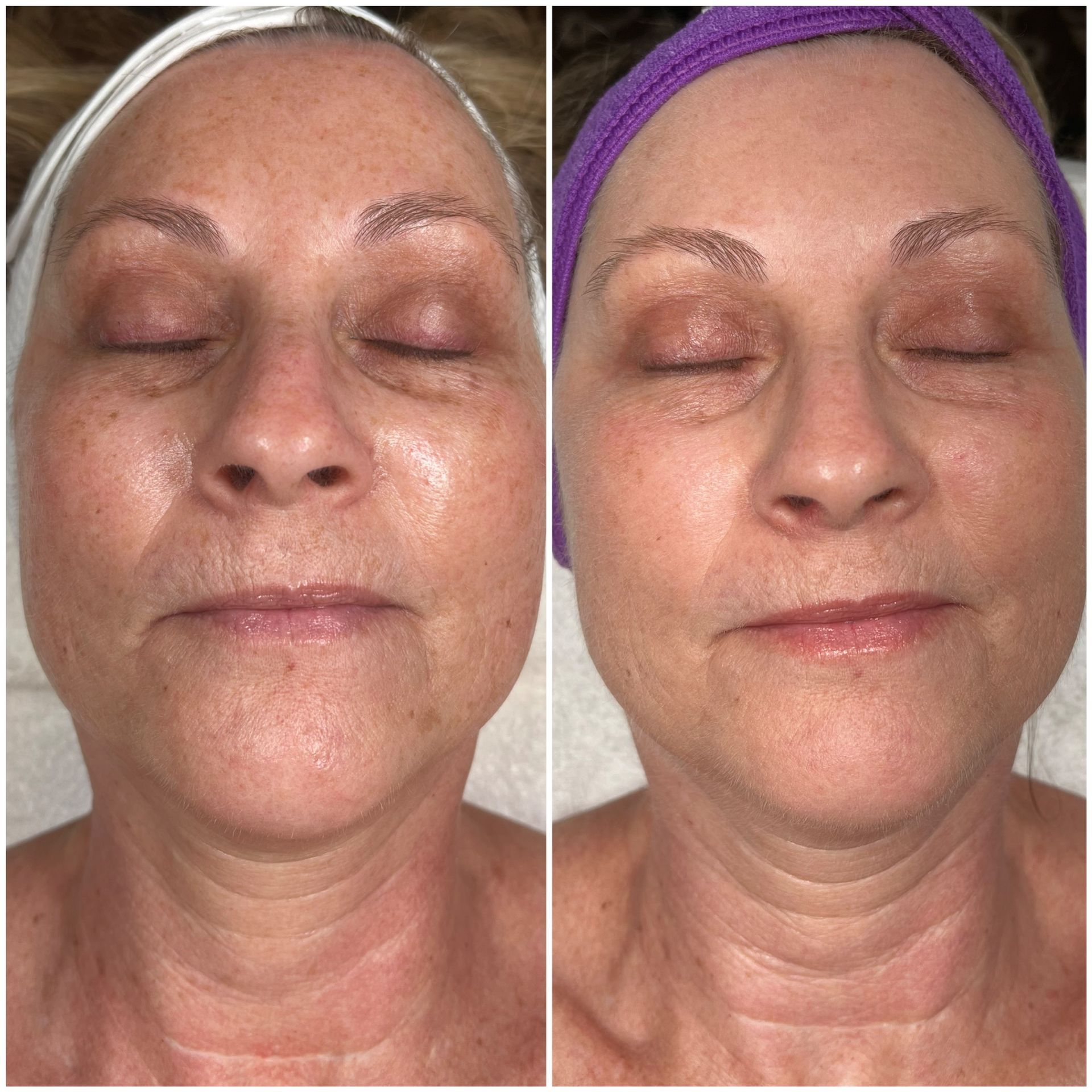 Pure Skin MedSpa Gallery