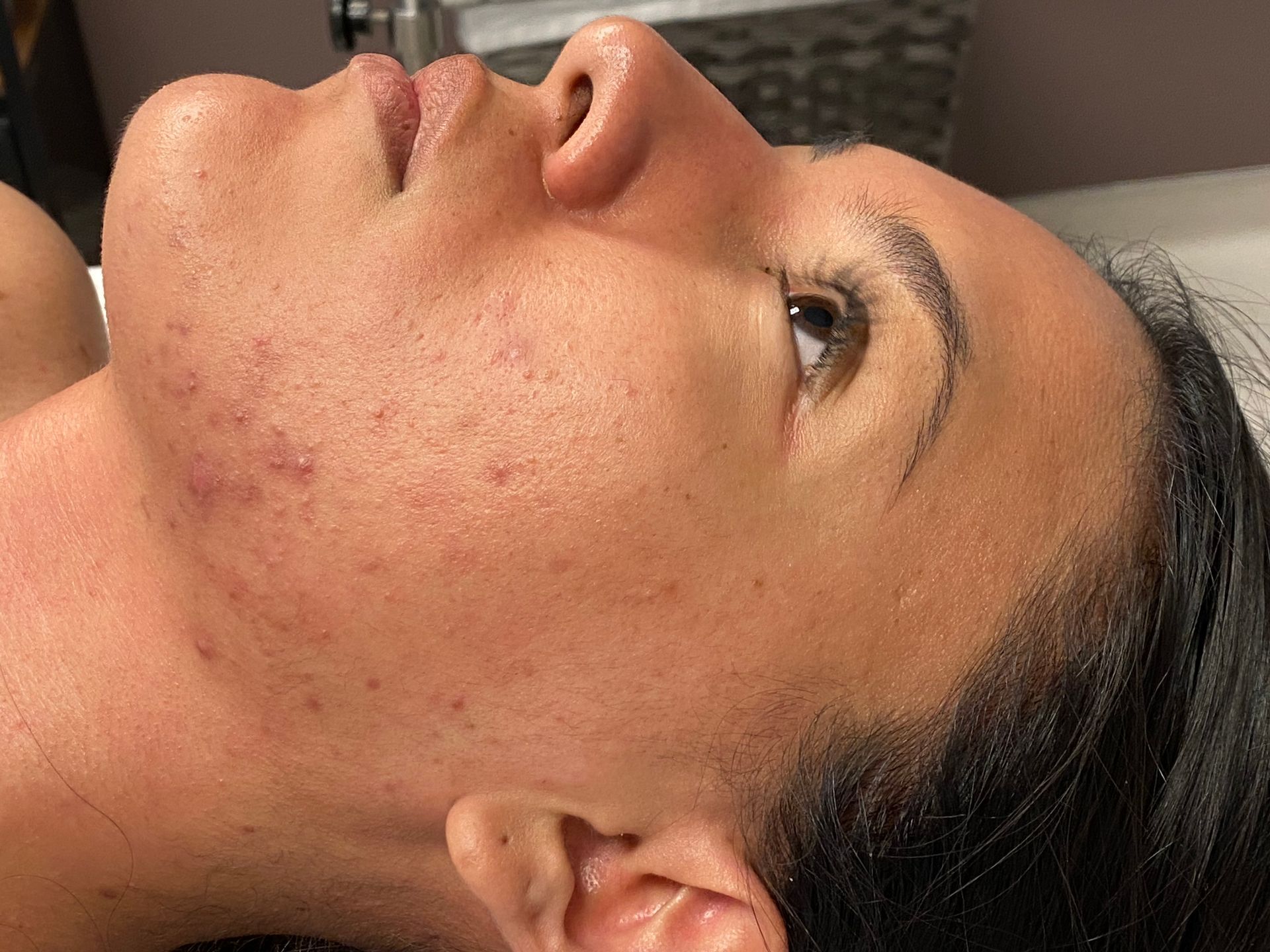 Pure Skin MedSpa Gallery