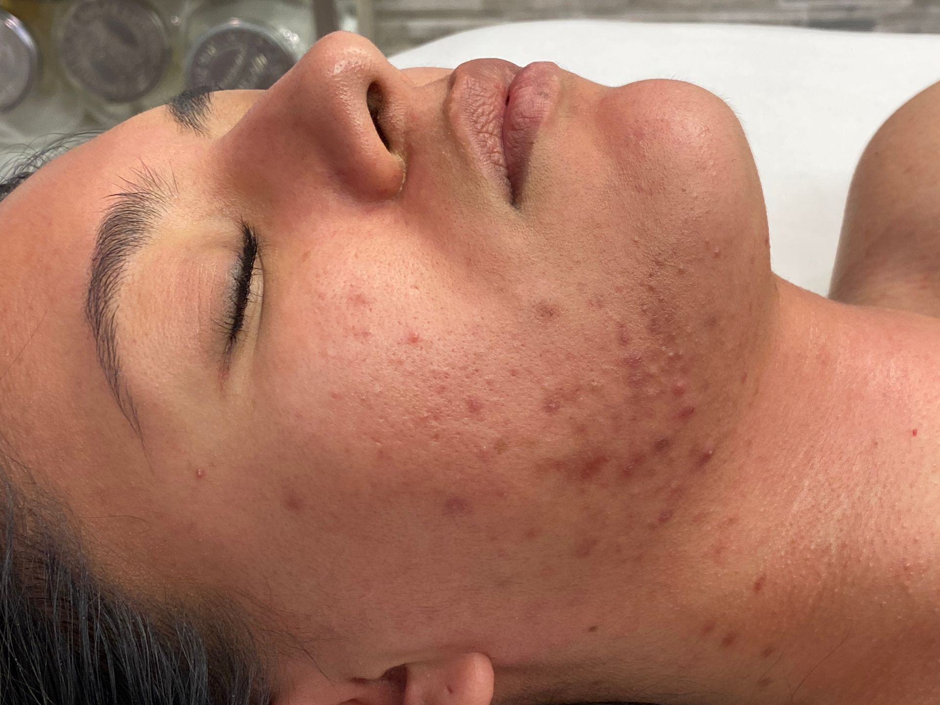 Pure Skin MedSpa Gallery