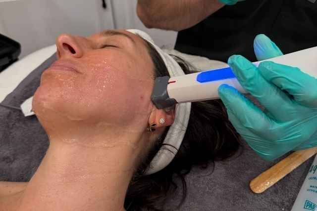 Xerf treatment