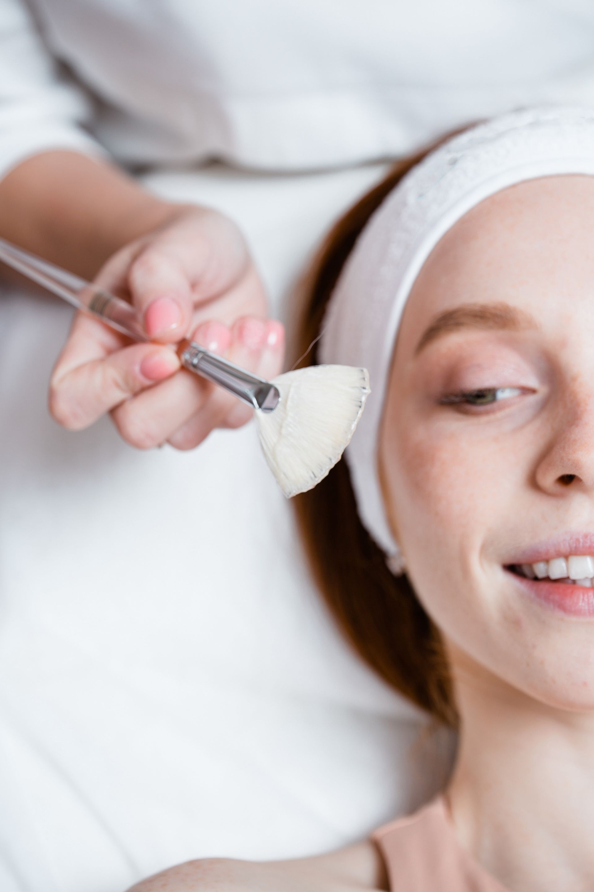 Chemical Peels Treatment