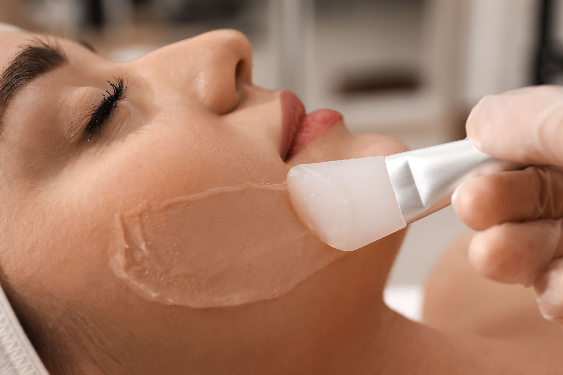 Chemical Peels Service
