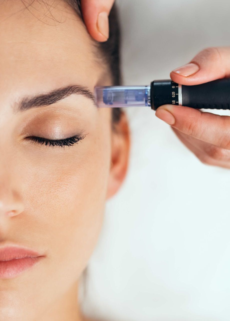 Microneedling SkinPen