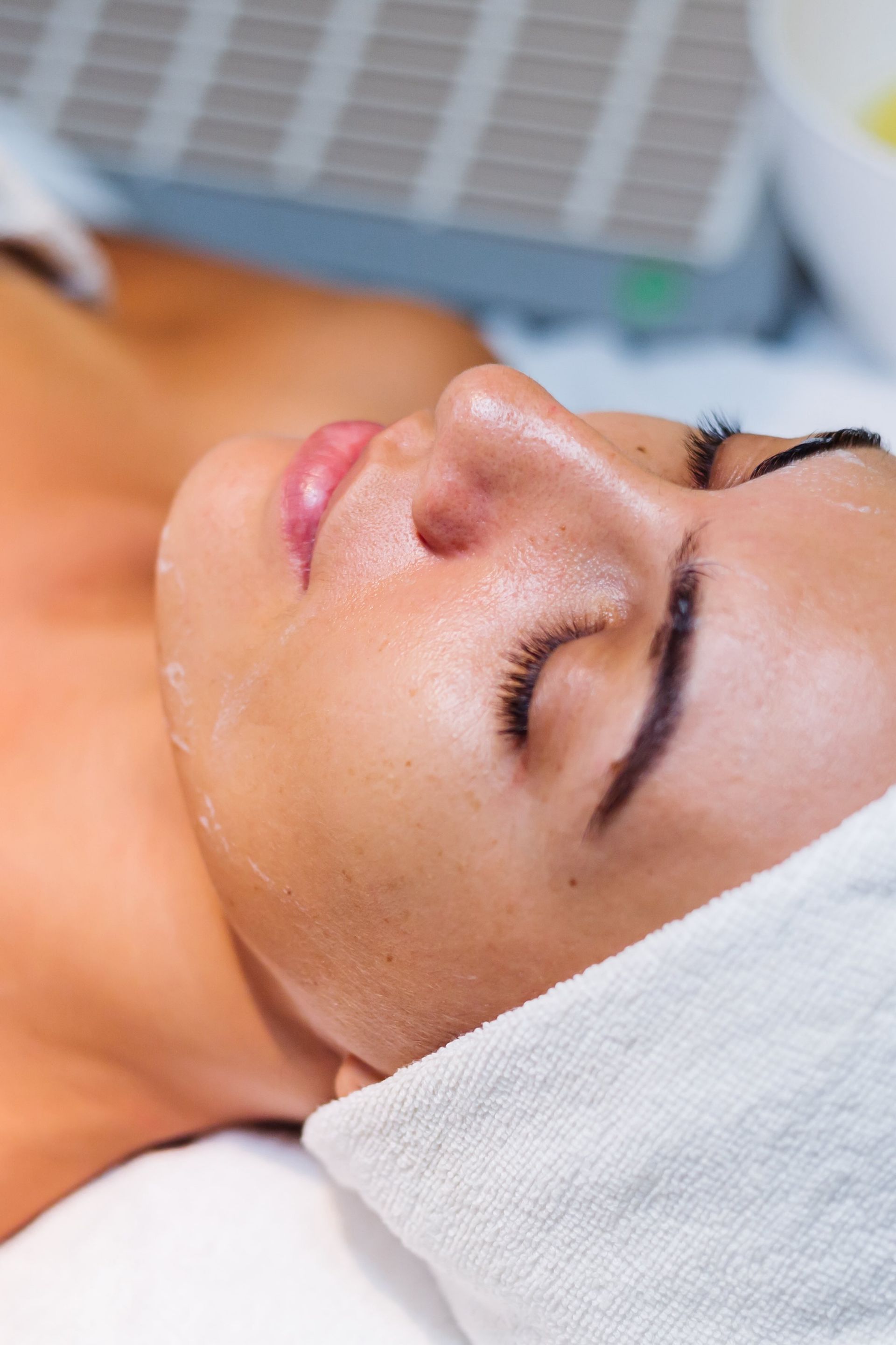 Chemical Peels Treatment