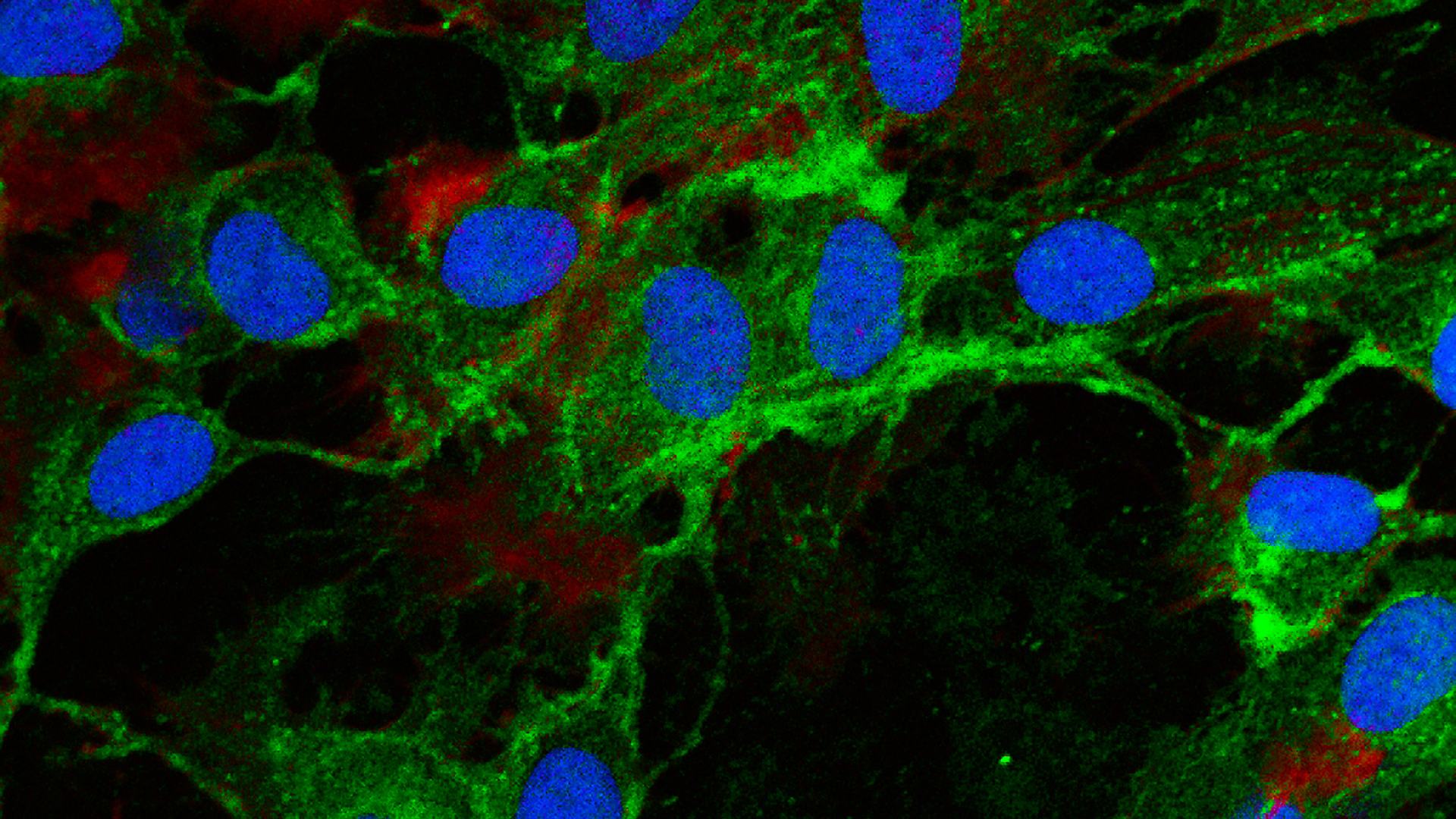 A close up of a green and blue cell under a microscope.