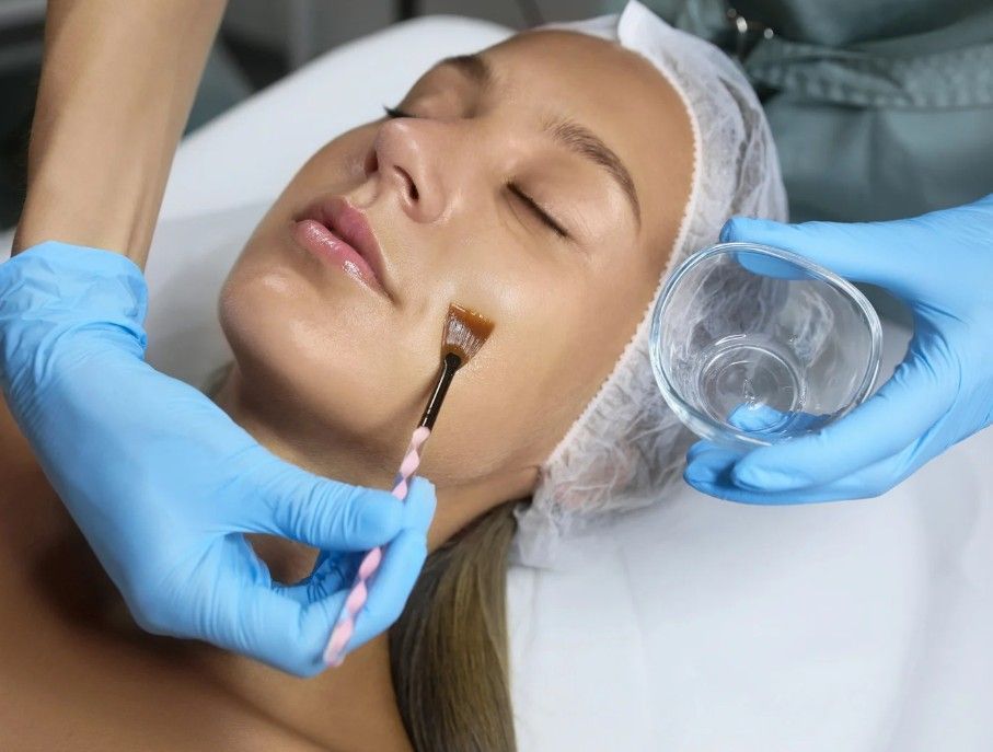 Professional chemical peel being applied to a client at the Coventry clinic