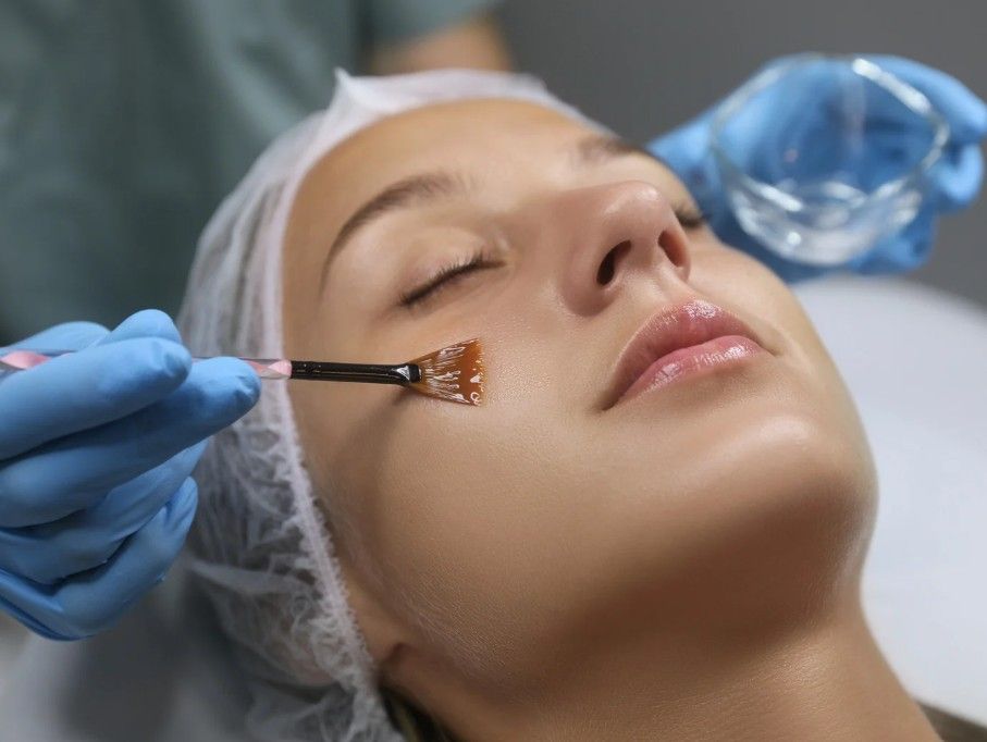 A chemical peel being applied at The Skinutrition Clinic in Coventry