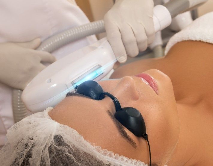The Skinutrition Clinic performing IPL Photo rejuvenation for a client in Coventry