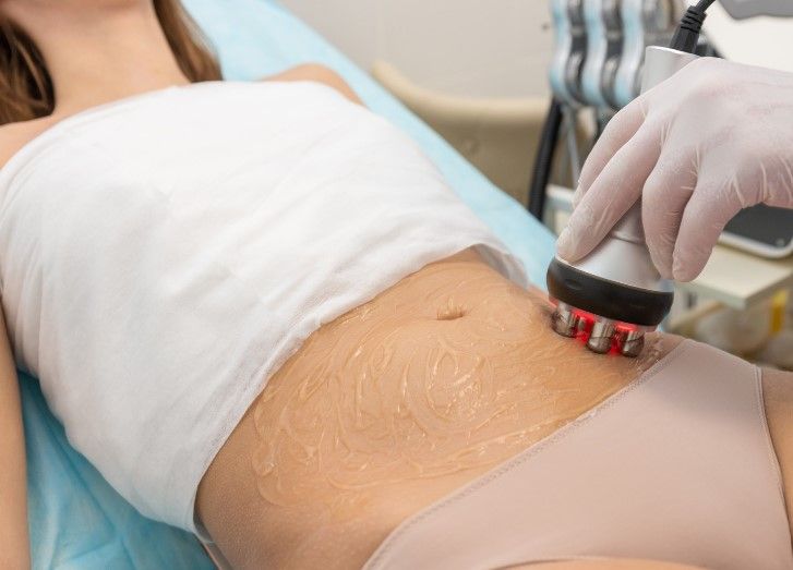 Skin tightening treatment being carried out on a client's abdomen at the Coventry clinic