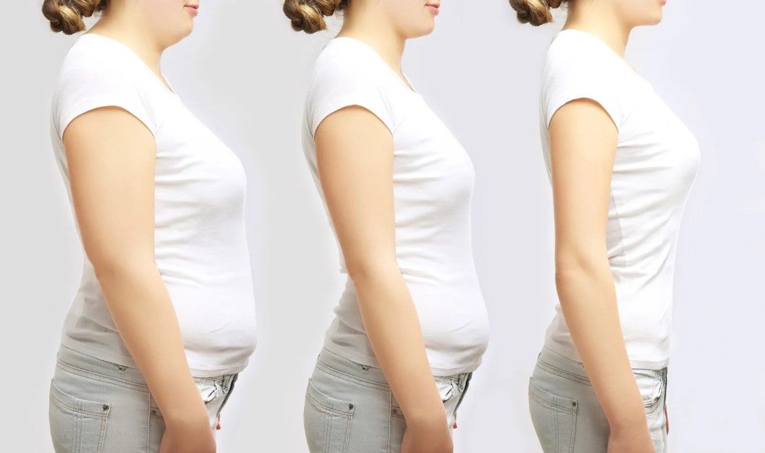 An illustration of three stages of weight loss, side by side