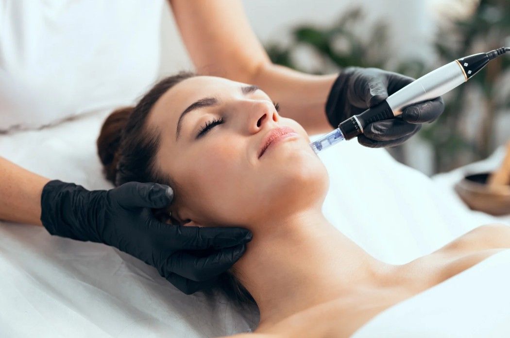 The Skinutrition Clinic commencing a microneedling treatment in Coventry
