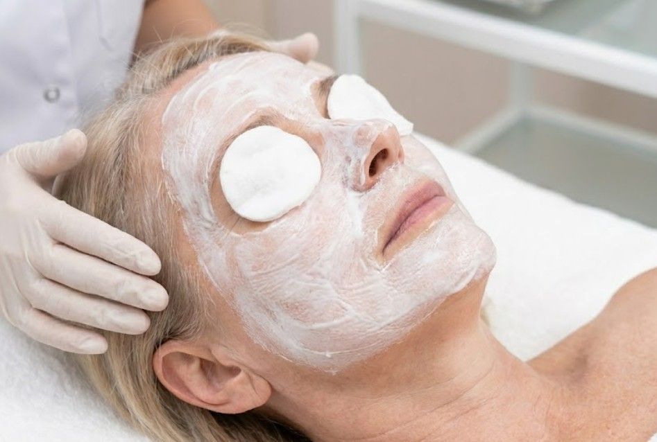 Client after a lactic peel with a thick, white neutralising mask applied to her face.