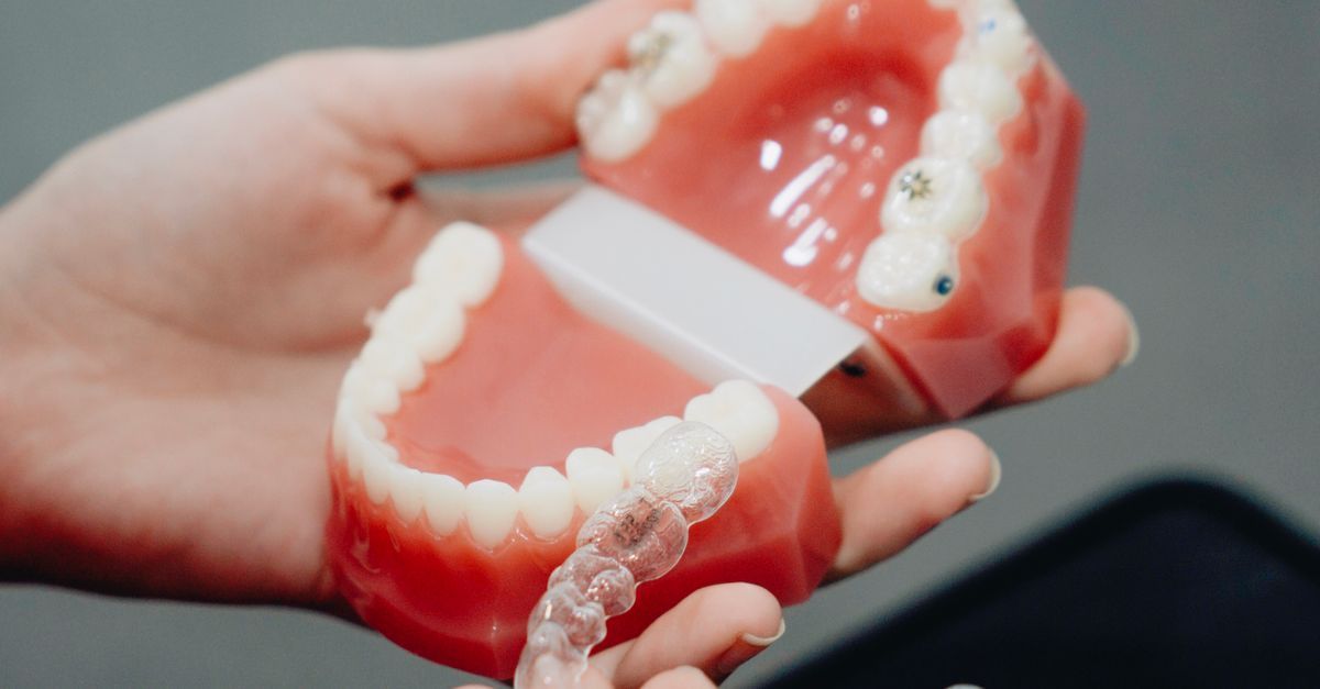 Orthodontic consultation in Seoul