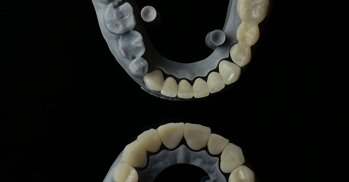 Orthodontic care at Isu Yonsei Baro Orthodontics in Seoul