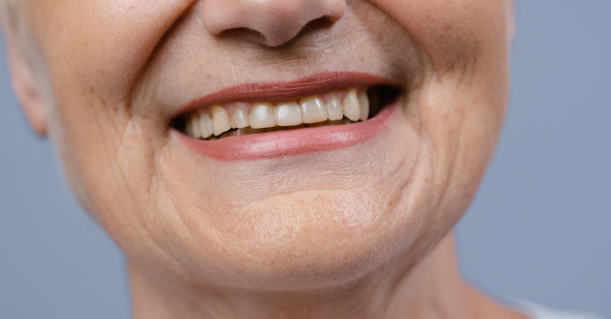 Orthodontic care at Isu Yonsei Baro Orthodontics in Seoul
