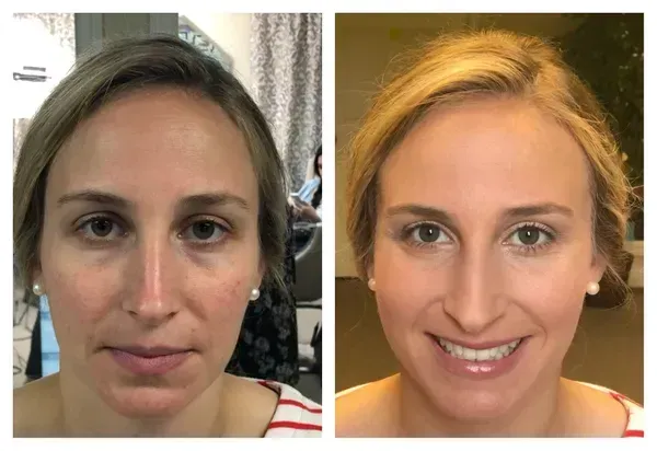 Before and after photos of a person showing a difference in skin tone and appearance after makeup application.