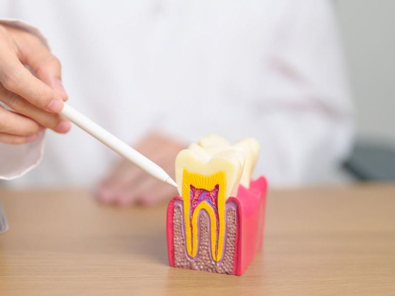 Cotton swab pointing at a dental cross-section model on a table