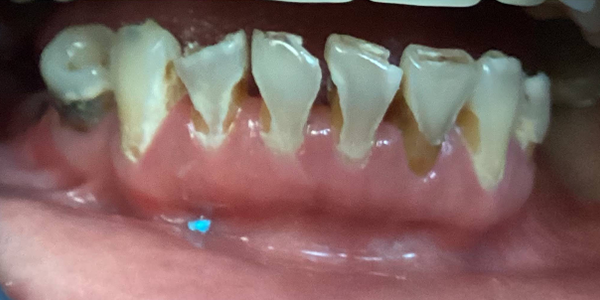 Before
