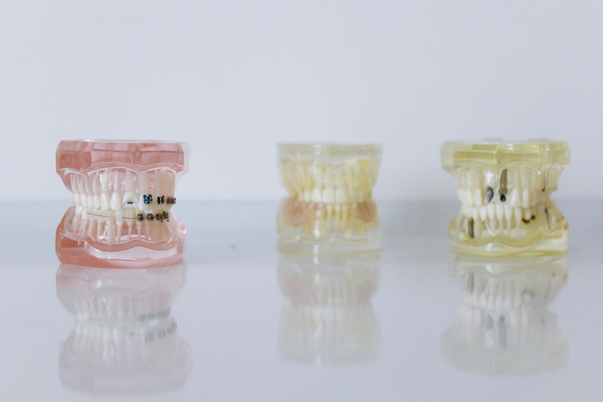 Three small translucent denture retainers in pink and yellow on a white surface with reflections