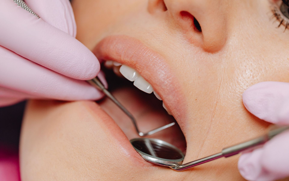 Teeth shown with a cheek retractor and mirror during a dental exam