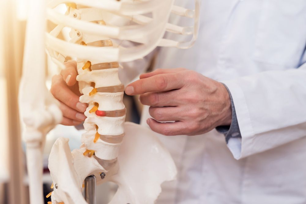 A Doctor Is Holding A Model Of A Human Spine — Back In Motion Chiropractic & Healthcare In Innisfail, QLD