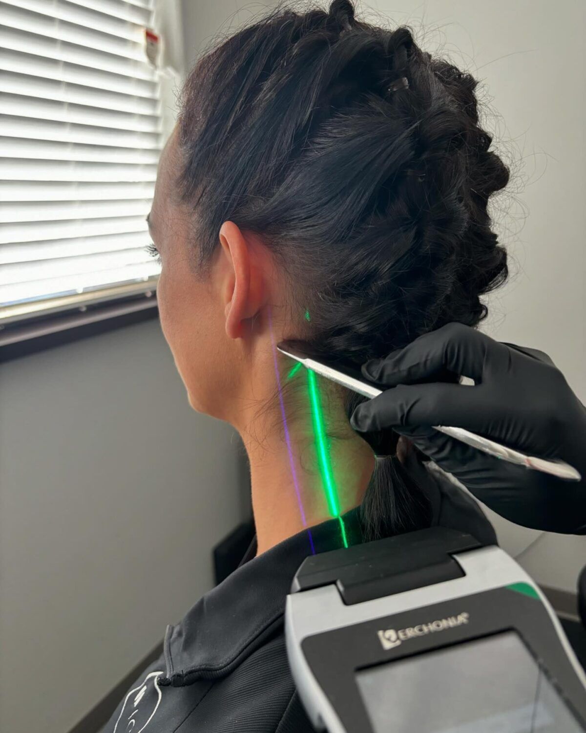 A Woman is Getting a Laser Treatment on Her Neck — Back In Motion Chiropractic & Healthcare In Innisfail, QLD