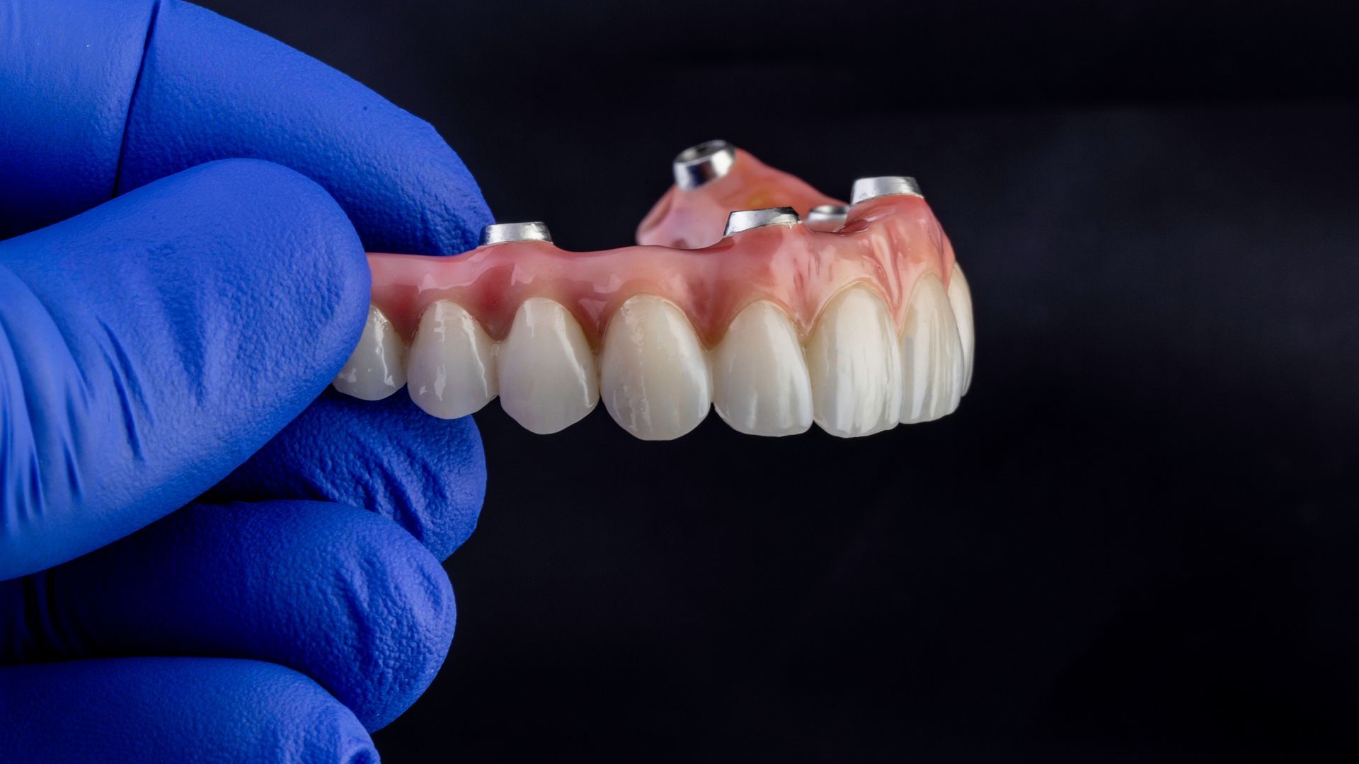 Dentist in white coat and mask examining a patient’s mouth with blue gloves in a dental clinic