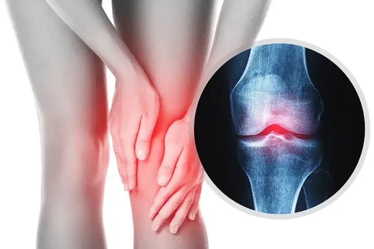 Knee Replacement Surgery with Grampians Hip and Knee Clinic